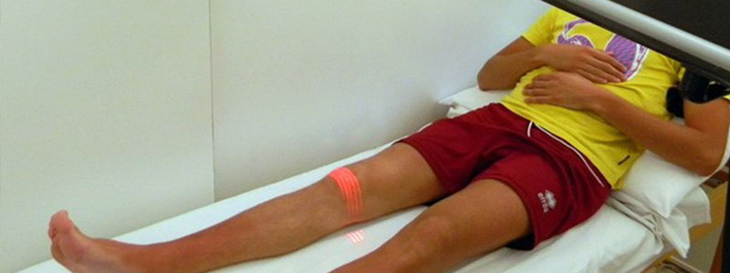 Laser co2 - Centro MFR di fisioterapia - Nola