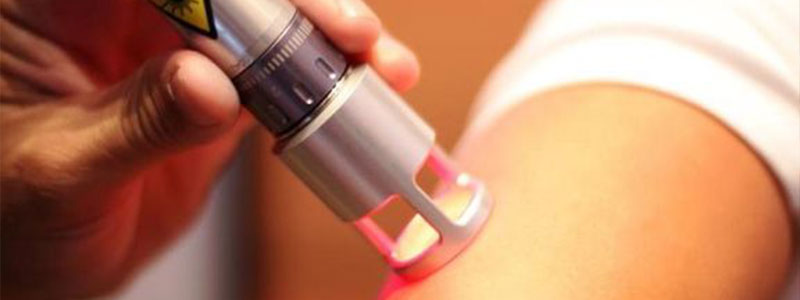 Laser Nd:YAG - Centro MFR di fisioterapia - Nola